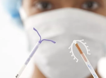 اعراض الحمل على اللولب وما هي أول علامة يجب الانتباه إليها وزيارة الطبيب ؟