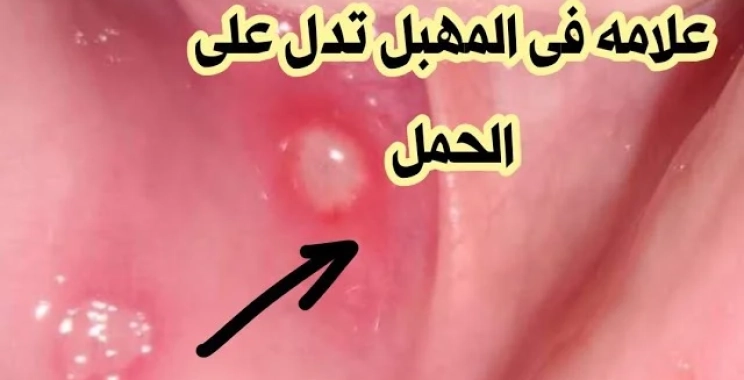أعراض الحمل على المهبل قبل الدورة وعلاماته