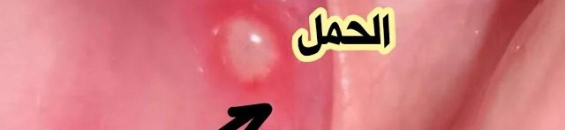 أعراض الحمل على المهبل قبل الدورة وعلاماته