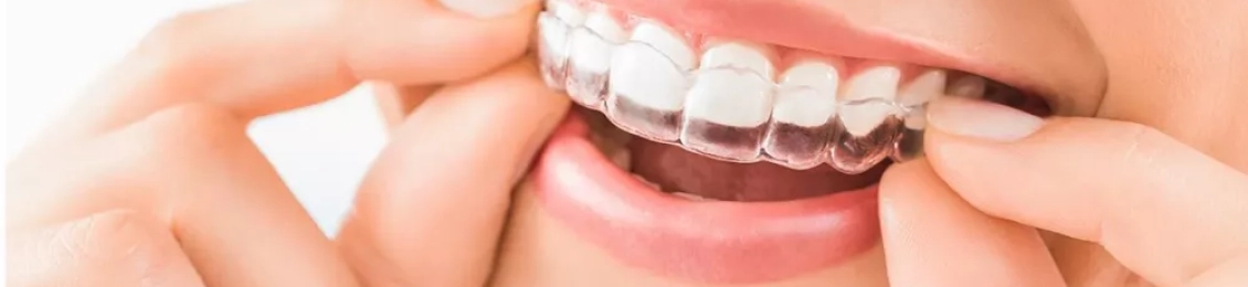 ما هي مميزات التقويم الشفاف المتحرك