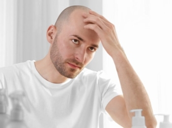 طرق علاج الصلع عند الرجال مع مركز الطب المتميز