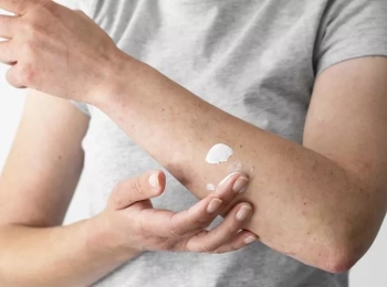 أهم طرق علاج فطريات الجلد في المنزل والحكه مع د.زينب جلال