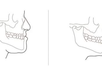 جراحة الفكين: لعلاج مشاكل تشوه الفك بأحدث التقنيات