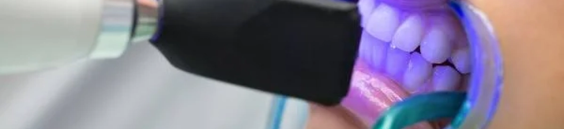 ايهما أفضل حشو الليزر أم البلاتين للأسنان: المميزات والسعر