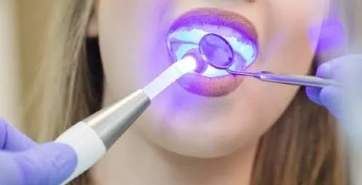 احدث تقنيات حشو الليزر للضرس 