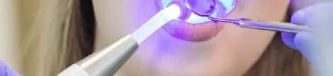 احدث تقنيات حشو الليزر للضرس 