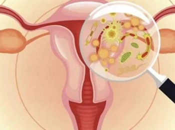 تشخيص أسباب التهاب المهبل وتغير رائحة المهبل 