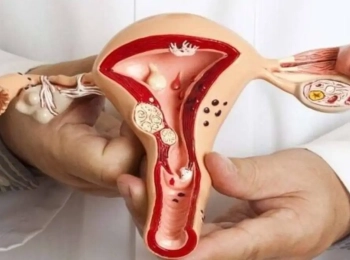 اهم اسباب التهابات المهبل المتكرر مع د.أُنس الشريف