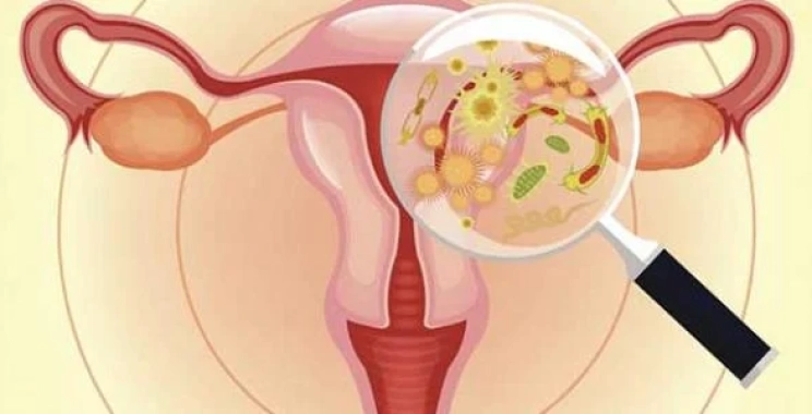 التهاب المهبل من الخارج الأسباب والأعراض والعلاج في أفضل مركز