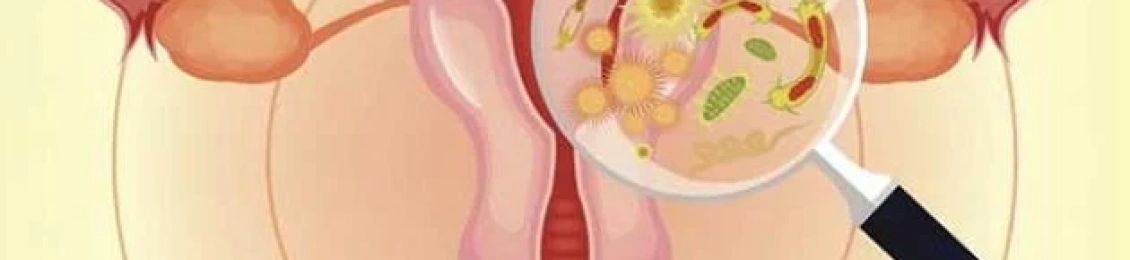 التهاب المهبل من الخارج الأسباب والأعراض والعلاج في أفضل مركز