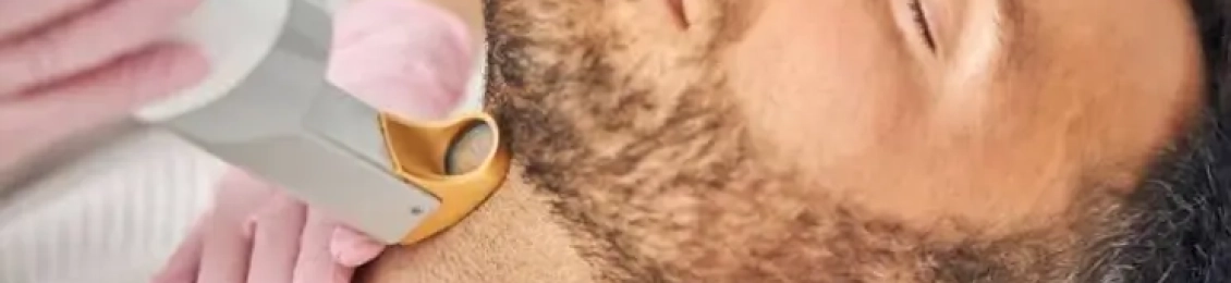 فوائد واستخدمات ليزر الوجه للرجال