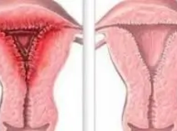 افضل دكتورة أشعة لتشخيص اعراض الالتهابات المهبلية