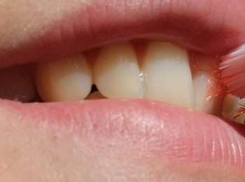 نصائح بعد تلميع الأسنان وأهم ممنوعات الطعام والشراب للحفاظ على أسنان بيضاء