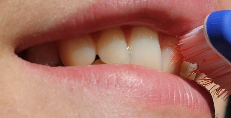 نصائح بعد تلميع الأسنان وأهم ممنوعات الطعام والشراب للحفاظ على أسنان بيضاء