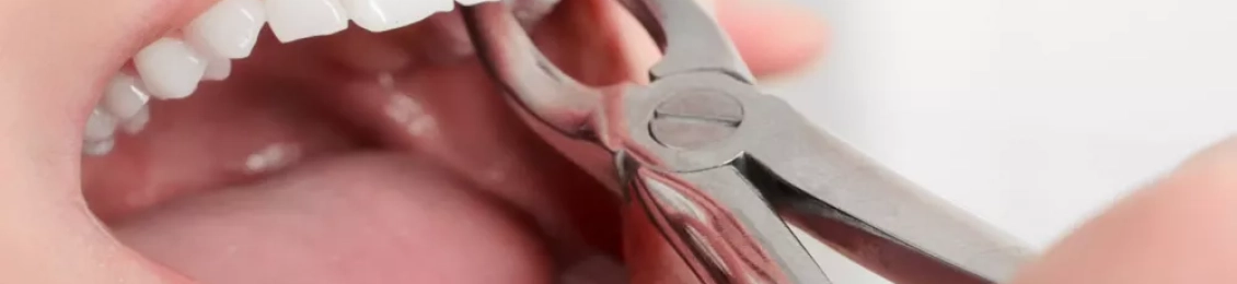 نصائح بعد خلع الضرس الملتهب: خطوات التعافي وتسكين الألم