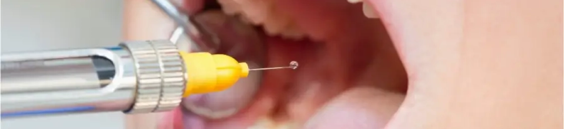 ما هي أنواع بنج الأسنان للاطفال؟ وكيف يختار الطبيب الأنسب؟