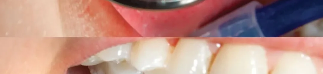 الفرق بين ألم التسوس وألم العصب: كيف تميز بينهما؟