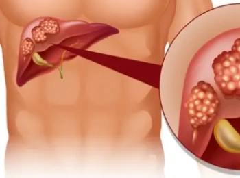 ما الفرق بين التهاب البنكرياس وسرطان البنكرياس؟