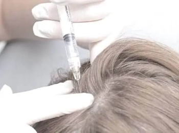 الفرق بين الميزوثيرابي والبلازما لعلاج تساقط الشعر