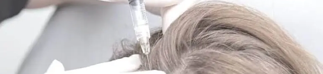 الفرق بين الميزوثيرابي والبلازما لعلاج تساقط الشعر