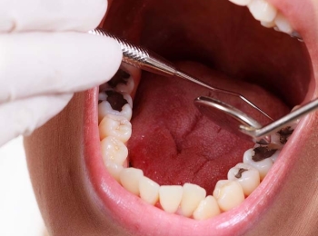 كيف تتخلص من الم الاسنان وطرق علاجه الفعالة