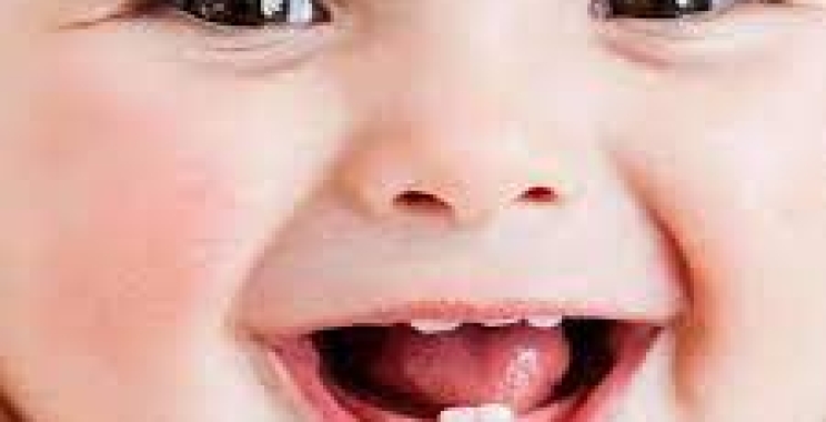 أسباب تسوس الأسنان عند الرضع وطرق الوقاية