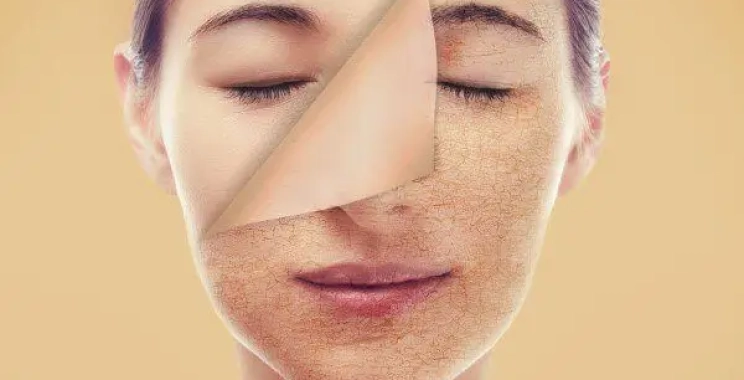 أفضل تقشير للوجه في العيادات: دليلك الكامل من مجمع الطب المتميز