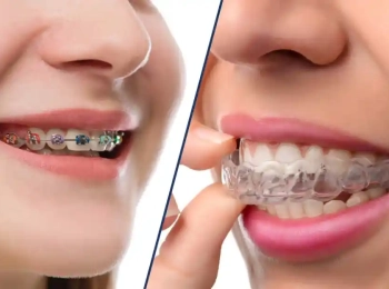 اسعار تقويم الأسنان التنافسية في مجمع الطب المتميز