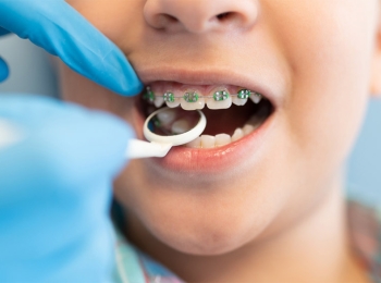 ما هي فوائد تقويم الاسنان للاطفال؟