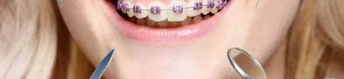 فوائد تقويم الأسنان للوجه مع د. إبراهيم زيتوني