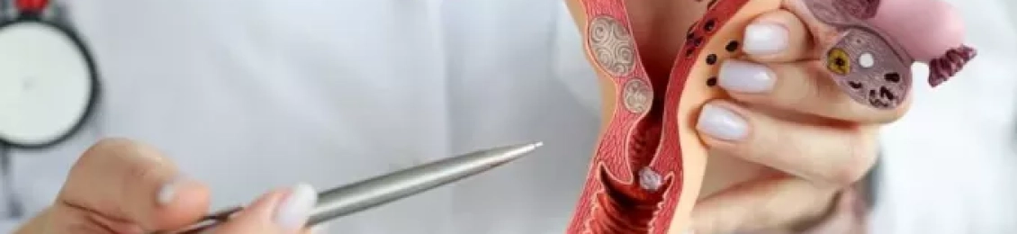 علاج تكيس المبايض للمتزوجة وأهم أسبابه