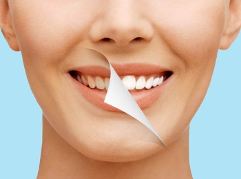 تكلفة تلميع الاسنان وكيف يتم تحديدها وأهمية إجراء التنظيف