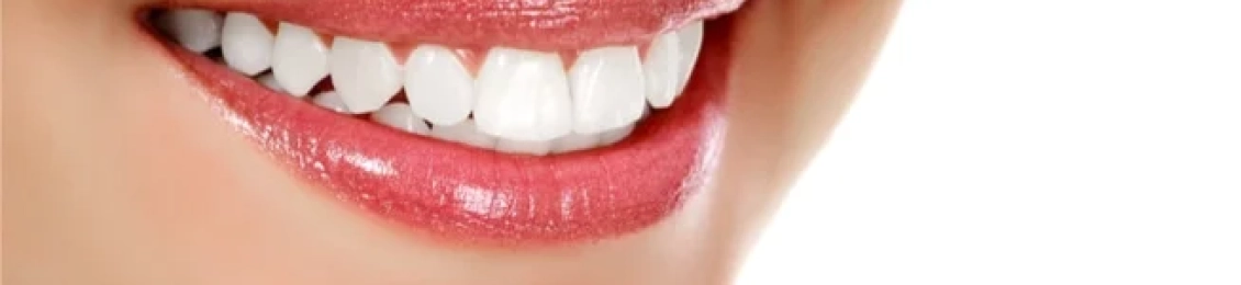 كم جلسة تحتاج ابتسامة هوليود؟ مع افضل اطباء الاسنان