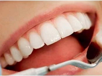 عروض حشو الاسنان أفضل أسعار الحشوات التجميلية في المدينة المنورة