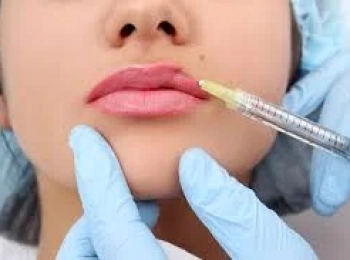 أماكن حقن الفيلر في الجسم: دليلك للحصول على نتائج طبيعية وآمنة