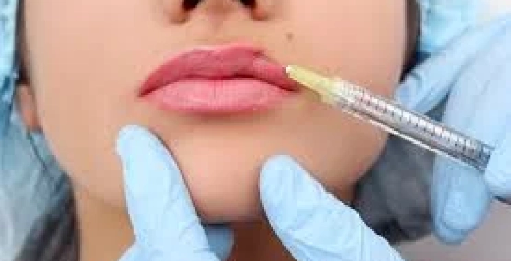 أماكن حقن الفيلر في الجسم: دليلك للحصول على نتائج طبيعية وآمنة