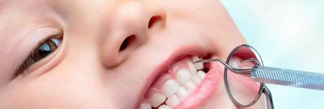 أفضل دكتور أسنان لعلاج العصب في مجمع الطب المتميز بالمدينة المنورة