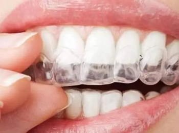 أفضل دكتور تقويم أسنان شفاف بالمدينة المنورة: كيف تختار الطبيب المناسب؟