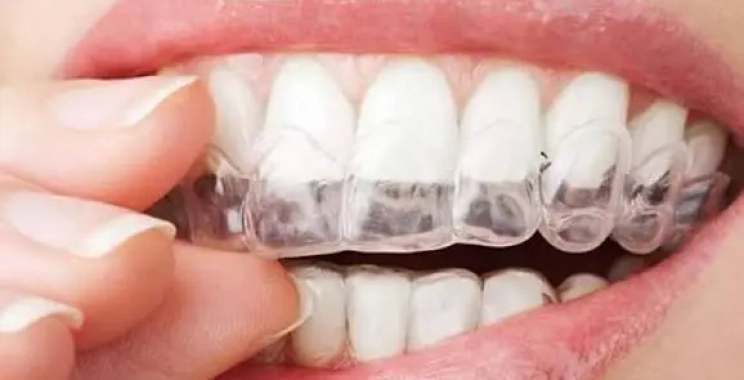 أفضل دكتور تقويم أسنان شفاف بالمدينة المنورة: كيف تختار الطبيب المناسب؟