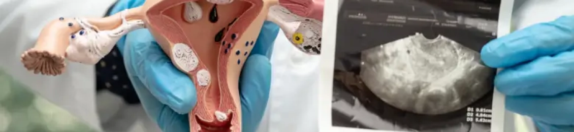 أفضل دكتورة نساء لعلاج التكيس في المدينة المنورة