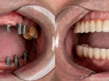 مجمع الطب المتميز: اهم مركز زراعة اسنان في المدينة المنورة 