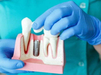 ما هي موانع زراعة الاسنان مع د.محمد بشار