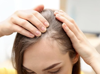 طرق علاج الثعلبة مع مركز الطب المتميز