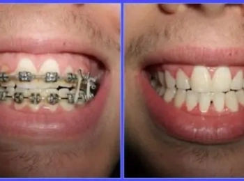 افضل عيادة اسنان المدينة المنورة رعاية وخدمات متكاملة