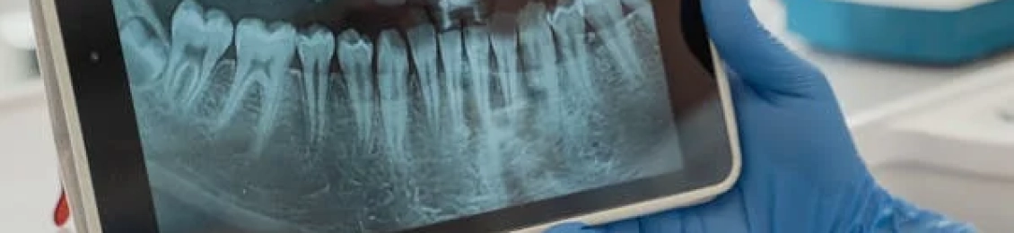 افضل عيادة تجميل اسنان بمجمع الطب المتميز