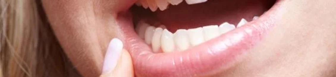 أعراض فشل زراعة الأسنان المبكرة وكيفية إنقاذ الزراعة قبل فوات الأوان