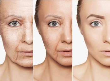 بوتوكس قبل وبعد وما يجب عليك عمله للحصول على نتيجة فعالة