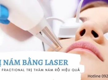 ماذا تعرف عن حشو ليزر تجميلي في المدينة المنورة