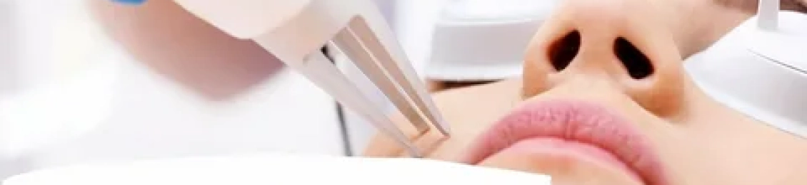 ماذا تعرف عن حشو ليزر تجميلي في المدينة المنورة