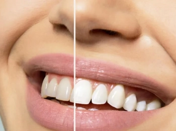 أفضل مركز تجميل الأسنان بالمدينة المنورة بخدمات حديثة